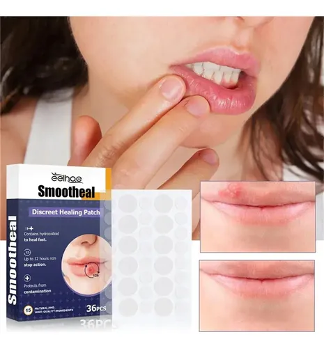 Tn 3 Parches Útiles For Aliviar El Herpes Labial Y Curar