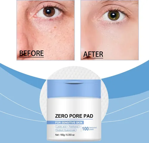 Almohadillas De Tóner Facial Pore Pads 2.0 Para Niños Y Pobr