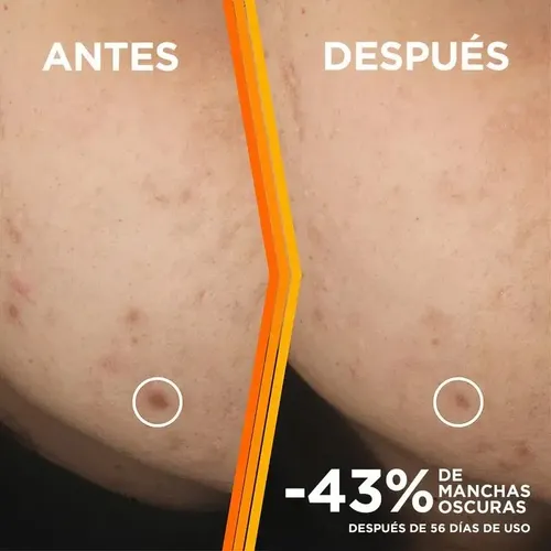 Garnier Serum Skin Active Anti-manchas Vit C 30 Ml