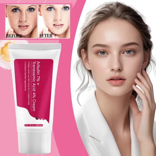 Crema Facial Tranexamic Para Tratamiento De Hiperpigmentació