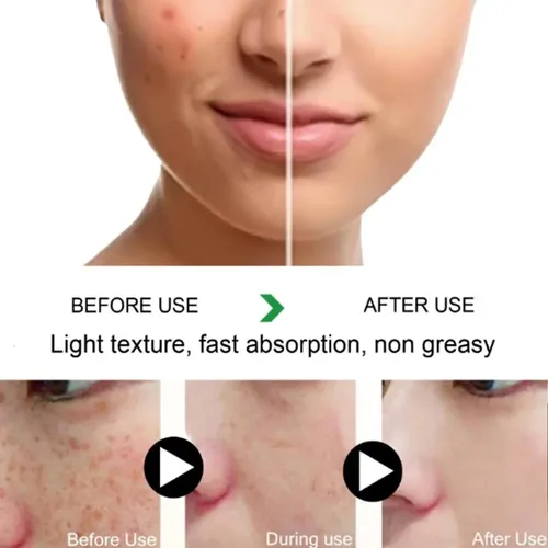 Ph Crema Blanqueadora Y Antipecas Fuyan De Nueva Mejora, 3