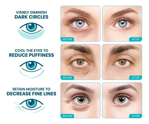 Parches Para Ojos Stylia Colágeno Marino 30 Pares