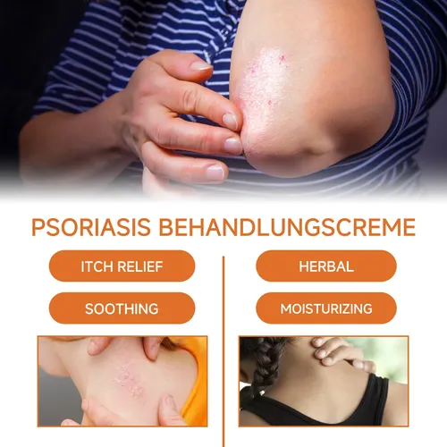 Crema Para El Cuidado De La Psoriasis Con Extracto De Miel D