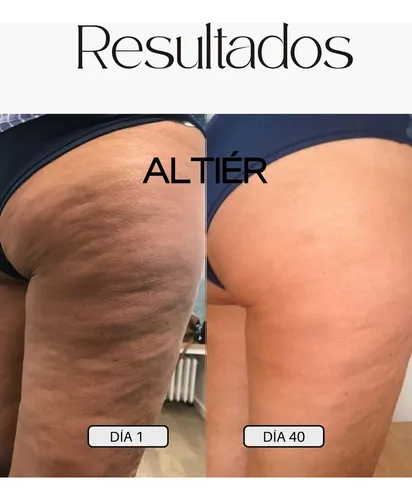 Crema Para Masajes Reductores Reafirmantes Altiér