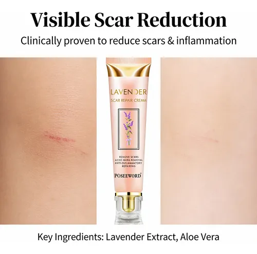 Crema Reparadora De Lavanda Crema For Marcas De Acné Facial