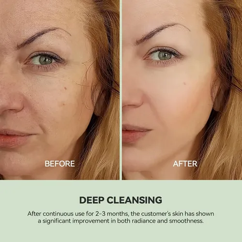 Mascarilla Limpiadora De Arcilla Wnp Duo Con Niacinamida Y Á