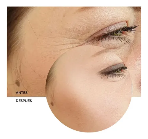 Sérum Facial Retinol 0.3% Niacinamida 5% Revox B77 X30ml