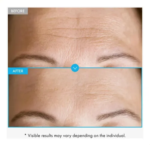 Sérum Peptídico De Belleza Y Cuidado De La Piel -*-