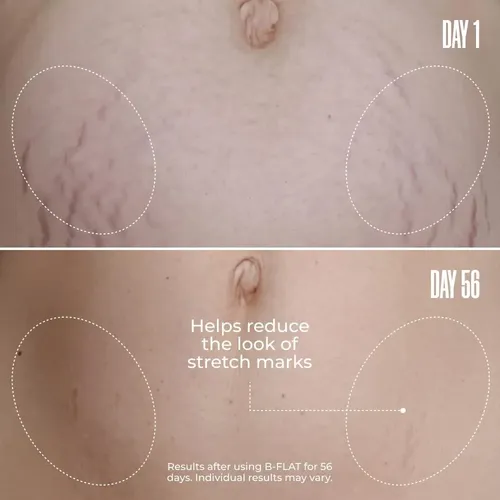 Dúo Reafirmante Abdomen Y Glúteos Maëlys
