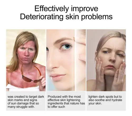 Sérum Facial Extracto Regaliz Hidratante Aclarante 30ml Momento De Aplicación Día/noche Tipo De Piel Mixta