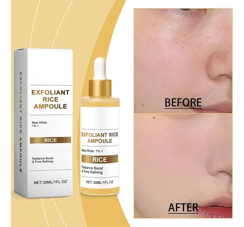 Sérum Facial Rice Essence Para Arrugas Que Hidrata Los Poros