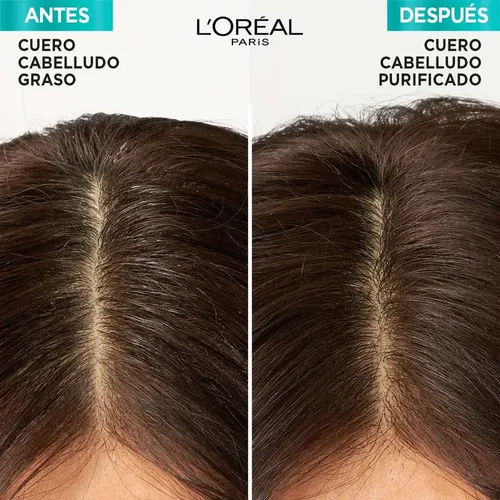 Shampoo Hialuronico Pure Elvive L’Oréal Paris 400 Ml