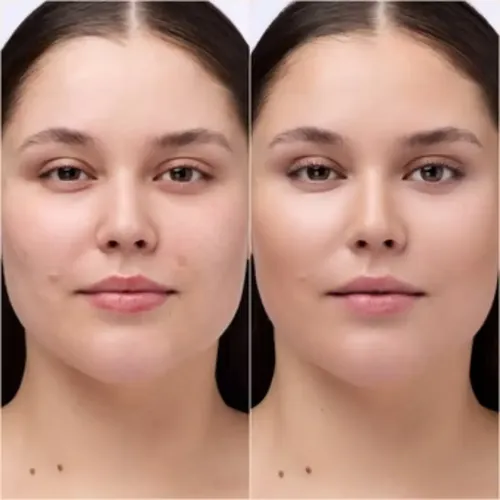 Primer Catrice Under Eye Brightener Crema 4.2g Instant Awake