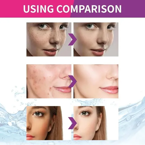 3*crema Urea Antimancha, Eliminación Reducir Manchas Oscuras