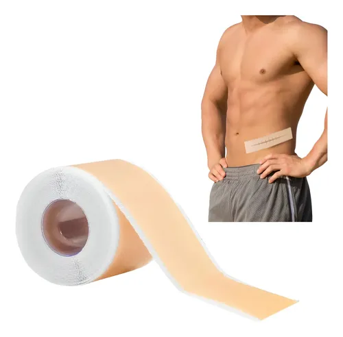 Cinta Cicatriz Cesarea Gaon Heridas Cuerpo Cirugia Queloide