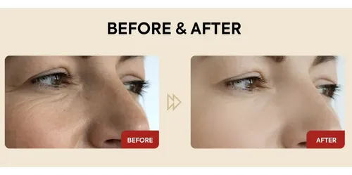 Serum Facial Retinal Liposomas 30ml Seoul 1988 Todo Tipo De Piel Día/noche