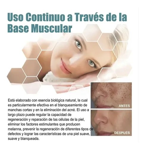 Crema Anti Manchas Oscuras 20ml Hiperpigmentación Facial