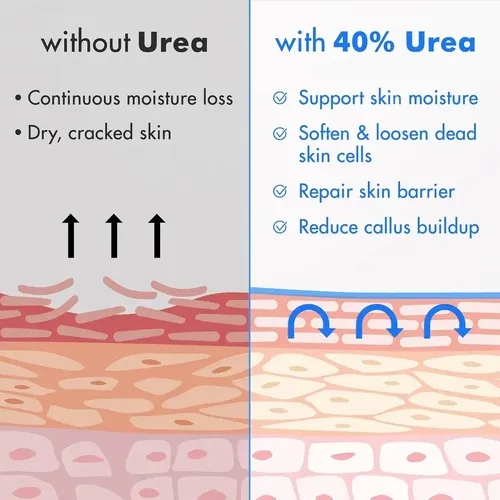/crema De Urea Ebanel 40% Más Ácido Salicílico, 2%,\.