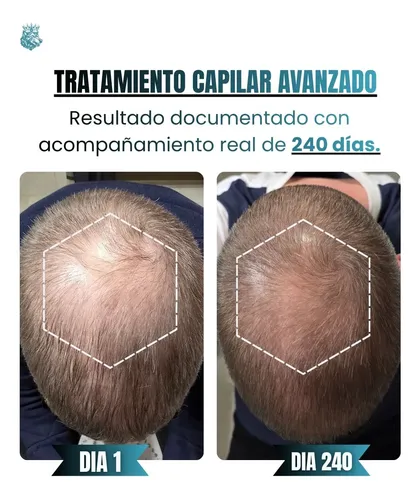 Serum Capilar Premium Anti-caída Con Péptidos De Cobre 30ml