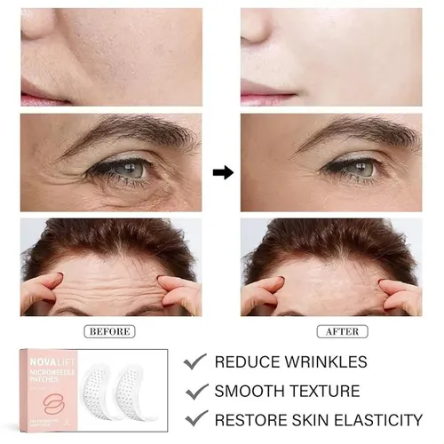 Qparches Micro Para Ojos, Parches Antiarrugas – 2 Piezas Mi