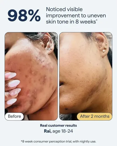 Loción Facial Hidratante For El Cuidado De La Piel, Cuidado