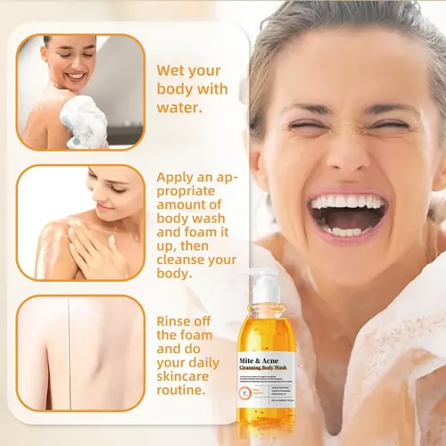 M/h Gel Corporal Limpiador Antiacné Y Ácaros 250ml Control