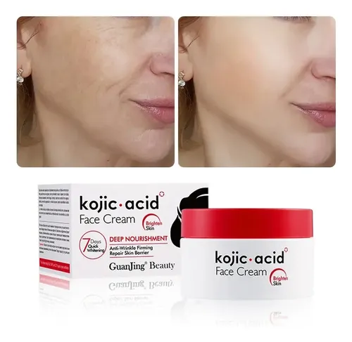 Crema Ácida For Manchas Kójicas E Dark A For El Rostro Y V