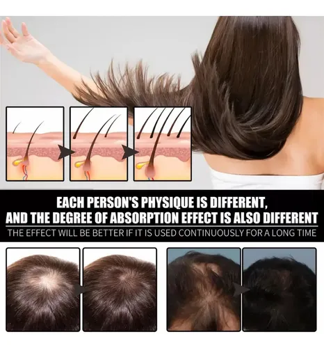 Aceite De Biotina Pura Para El Crecimiento Del Cabello