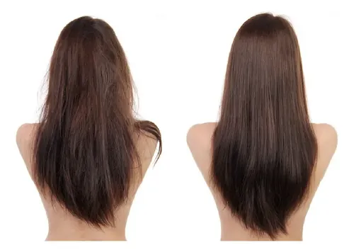 Shampoo Almedras Coco Y Acido Hialuronico 5lts Caba Belgrano