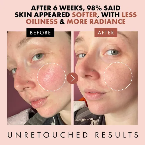 Skincare Rose Water Toner  Hydrating Toner For Face –