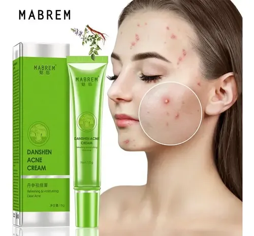 Crema Eficaz En Gel Para El Acné, Eliminación De Manchas A B