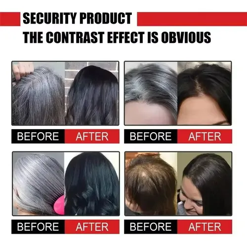 Crema A Base De Hierbas Para Cabello Blanco Contra Las Canas