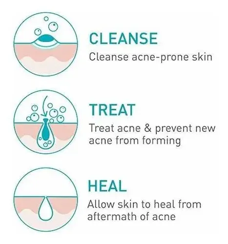 Crema Limpiadora Y Espumosa Para El Acné Cerave
