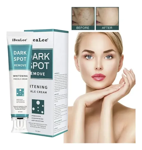 Crema Anti Manchas Oscuras 20ml Hiperpigmentación Facial