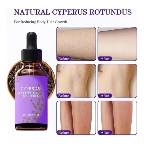 Barato/3 Aceites Cyperus Rotundus Para Depilación E Hidratac