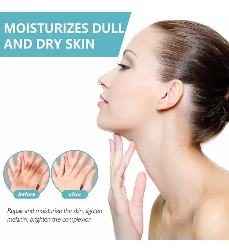 Hd Fixderma Nigrifix Crema Para Acantosis Nigricans Fbg,h