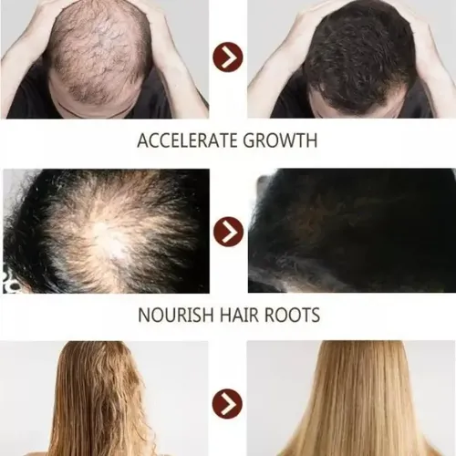 W El Sérum Para El Crecimiento Del Cabello Promueve El W