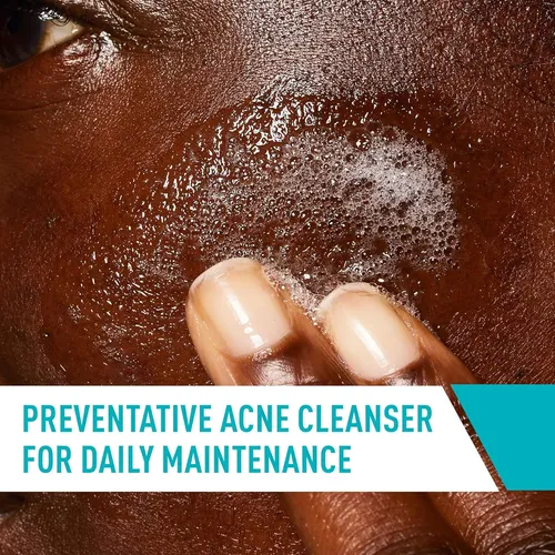 Limpiador Facial Cerave Con Ácido Salicílico Para El Acné