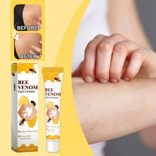 Crema Para El Cuidado Y Reparación De Manchas Blancas Para E