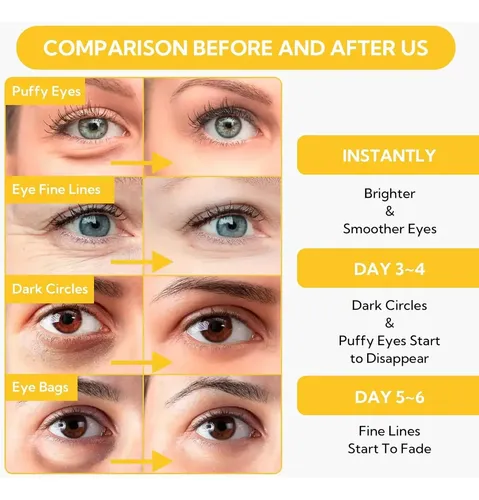 Lanbena Parches 24k Gold Hydra-gel 60 Unidades Todo Tipo De Piel