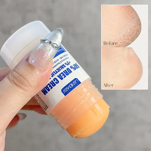 An+a Crema De Urea Máxima Fuerza Para Pies An