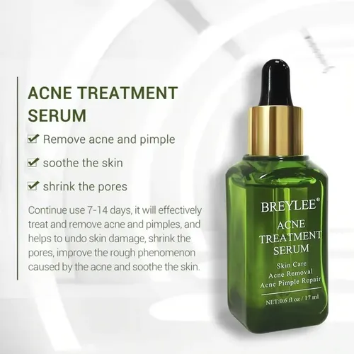 Tratamiento Para Acne Serum Comedones Pieles Grasas Importad
