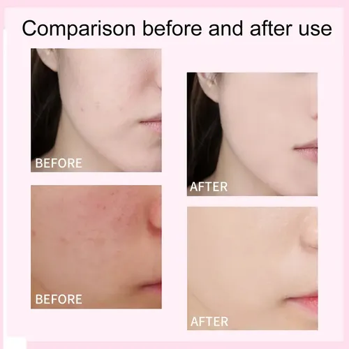 + Crema Blanqueadora Antiarrugas Con Colágeno E Hidratante .