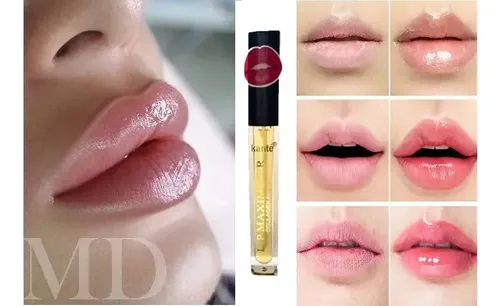 Brillo Labial Voluminizador, Efecto Relleno, Colageno