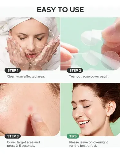Parche Anti Acne Granos Puntos Negros The Right Choice X36