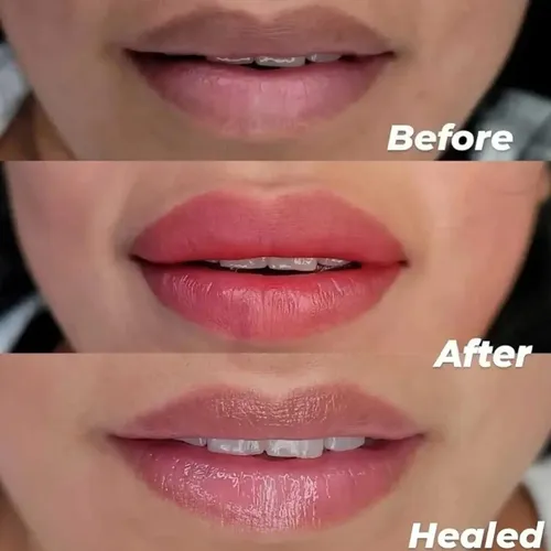Cepillo Exfoliante De Labios Youkool Doble Cara Silicona