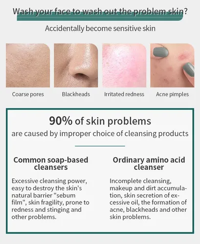 Limpiador Facial Blanqueador, Control De Manchas Y Grasa