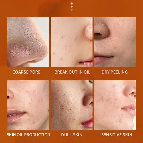 Crema Exfoliante Facial Y Corporal