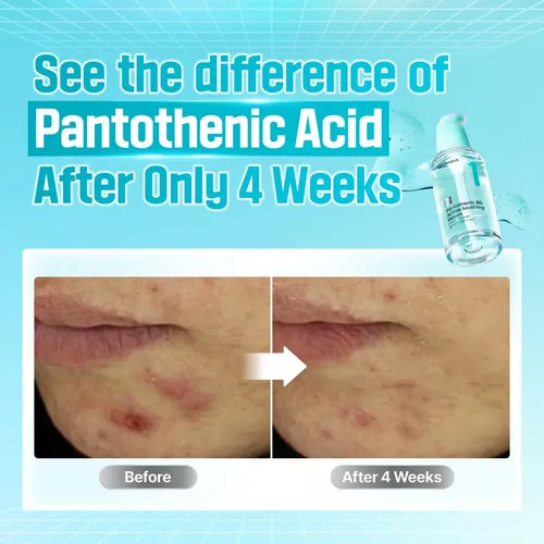 Numbuzin No.1 Pantothenic B5 Active Soothing Serum 50ml Momento De Aplicación Día/noche Tipo De Piel Todo Tipo De Piel