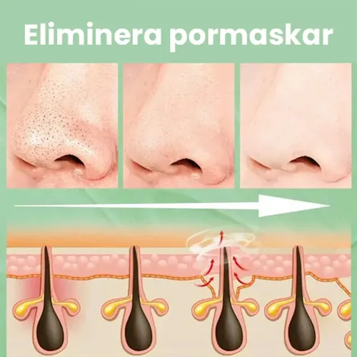 I Mascarilla De Arcilla Puntos Negros Nariz Removedor I